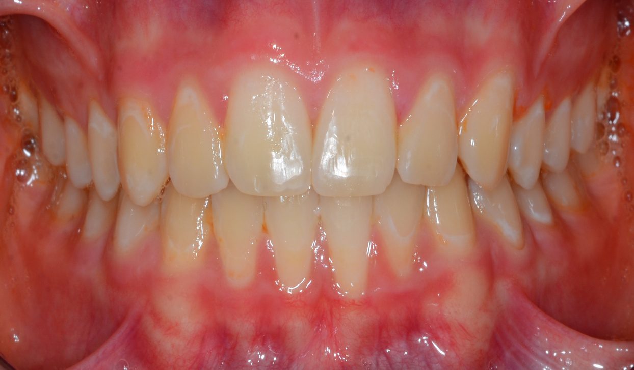 Close-up of healthy human teeth and gums